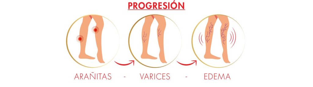 verano,piernas