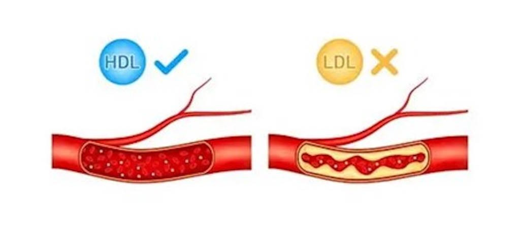 corazon,colesterol,hdl,ldl